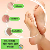Pumice Callus Remover PUMI Bar: Pedicure Stone & Foot/Heel Scrubber - Medium Grit (Assorted Colors) 4 Pack